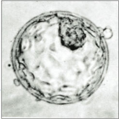 blastocysta